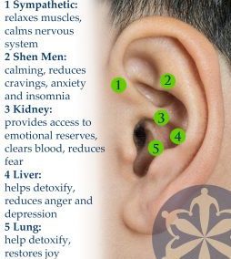 SummitStone now offers ear acupuncture in Estes Park
